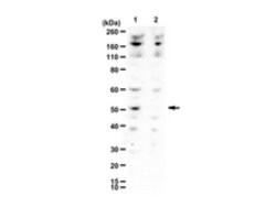 Atrial Natriuretic peptide Rabbit anti-Mouse, Rat, Polyclonal, Chemicon:Antibodies:Primary